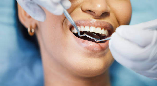 Best Pediatric Emergency Dentist in Cumberland Head, NY